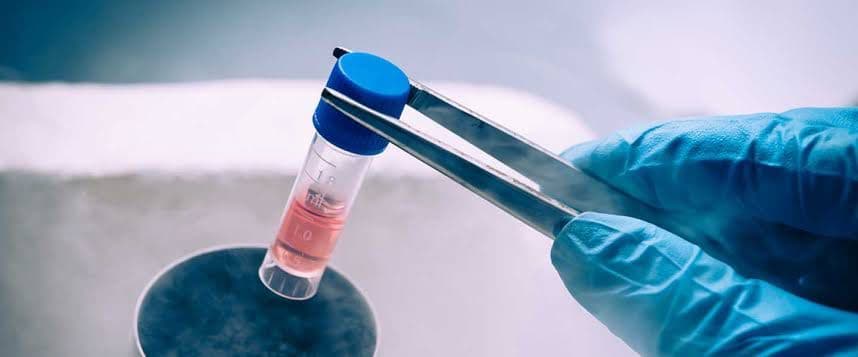 Autologous Stem Cell Therapy